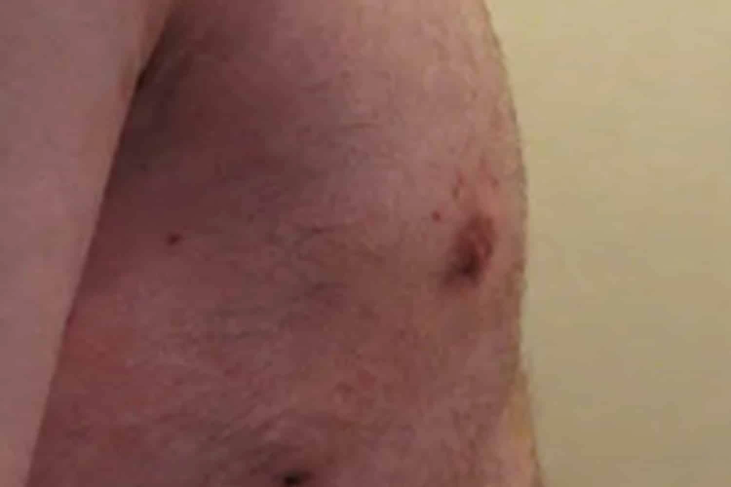 Male chest before body augmentation, side profile view